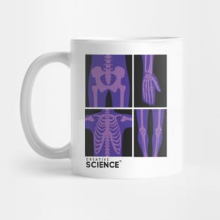 Medicine: Purple X-Ray Mug